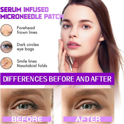 MicroNeedle Patches by NovaLift