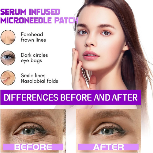 MicroNeedle Patches by NovaLift