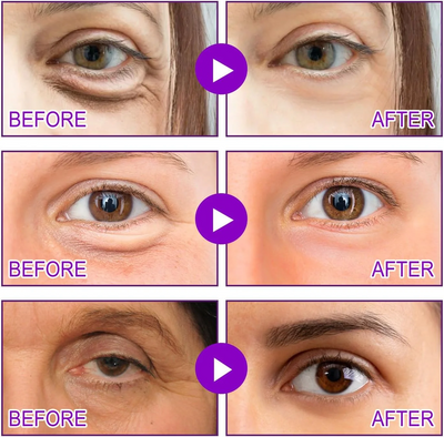 MicroNeedle Patches by NovaLift