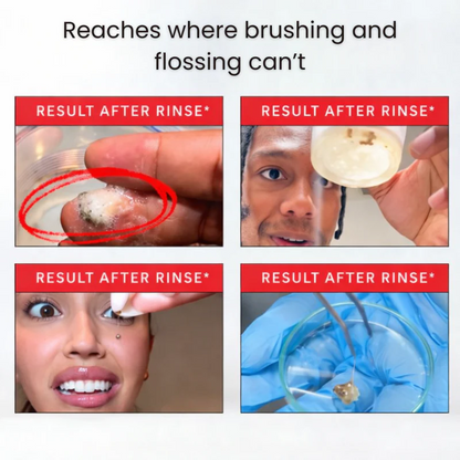 CelluMed™ iD Stain Mouthwash